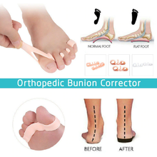 Load image into Gallery viewer, Orthopedic Bunion Corrector 2.0