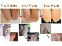 Load image into Gallery viewer, Deep Moisturizing &amp; Exfoliating Feet Peel Mask (1 Pair Set)
